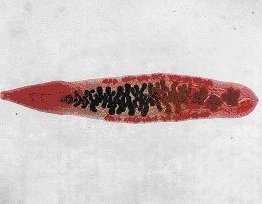 az opisthorchiasis pinworm)