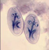 Giardia microscopy