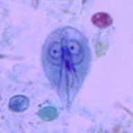 Giardia microscopy - Paraziták Srí Lanka